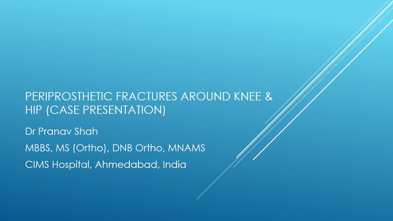 Periprosthetic Fractures Around Knee Hip Case Presentation Periprosthetic Fractures Around Knee Hip Case Presentation