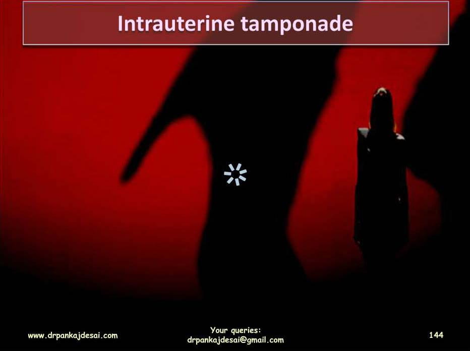 image NP