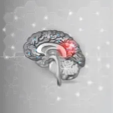 brain_hemorrhage