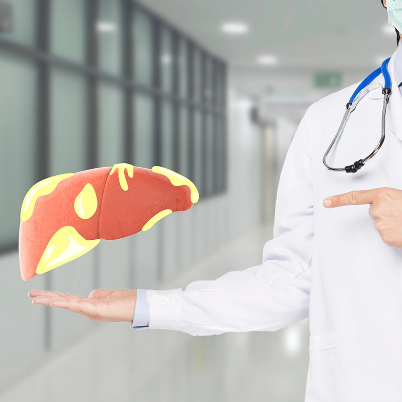 Liver Visceral and Subcutaneous Fat A Comparison between South Asian